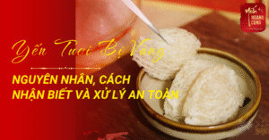 yen-tuoi-bi-vang-0